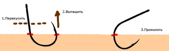 Вытащить крючок, зацепившийся за тело